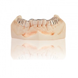Splint-Rock, desert-cream 5kg