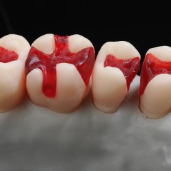 SHERA Plast 3x3g